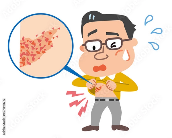 Obraz 帯状疱疹　発疹を確認する中年男性のイラスト