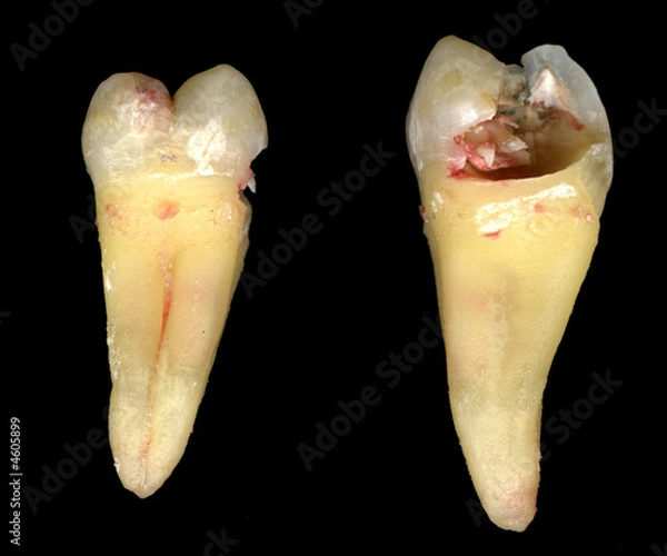 Fototapeta Tooth #18