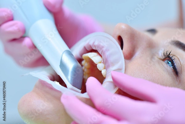 Obraz Orthodontist using 3D intraoral scanner for scanning teeth patient's.