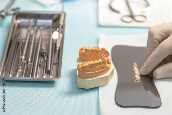 Obraz Anterior denture prosthesis for implant placement.