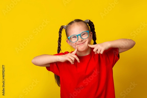 Fototapeta Happy girl with Down syndrome having fun and laughing in the studio