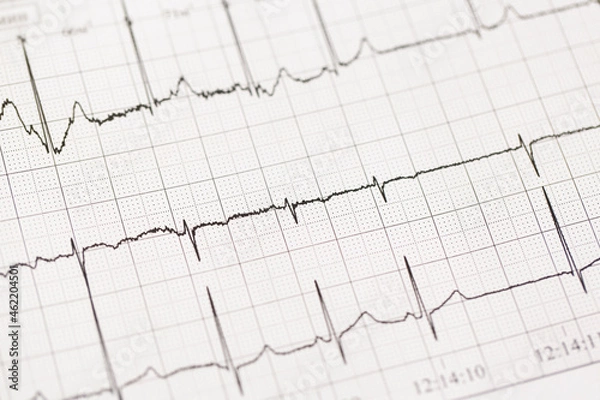 Fototapeta Close up of ECG, electrocardiogram. The work of a healthy heart on paper.