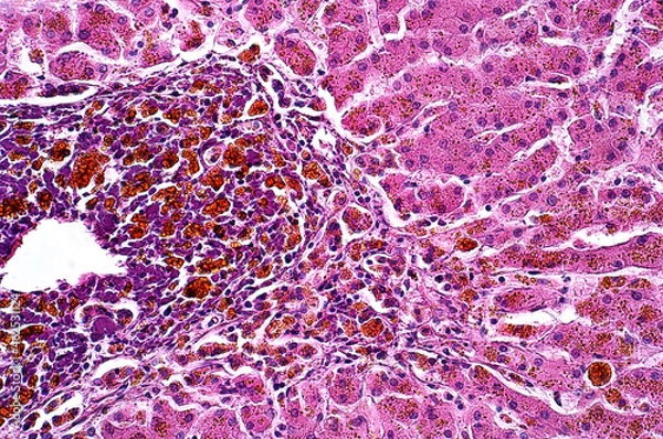 Obraz Light microscope Pigmentary of liver pathology.
