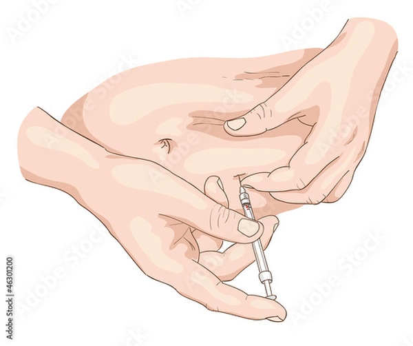 Obraz Insulin injection in a belly.