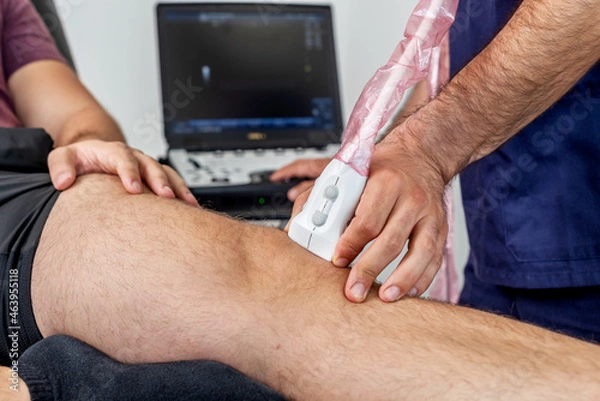 Fototapeta Close-up of a physiotherapist performing an ultrasound of the knee on a patient lying on the stretcher