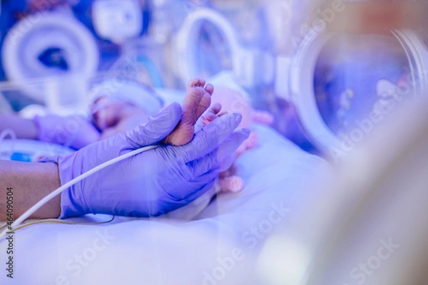 Fototapeta Macro photo of doctor's hands and legs of a child. Newborn is placed in the incubator. Neonatal intensive care unit
