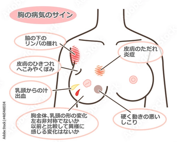 Obraz 胸の病気のサイン