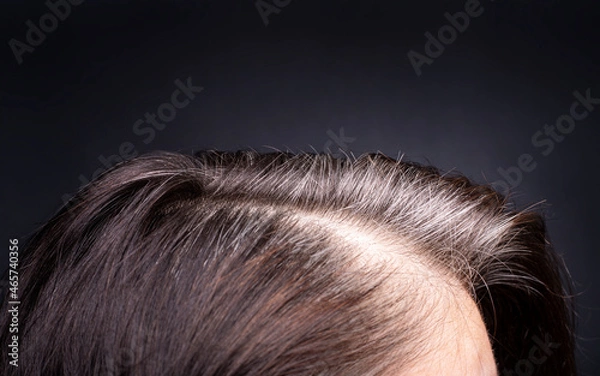 Fototapeta Womens head with gray hair, close-up view of regrown roots, top view on dark background.