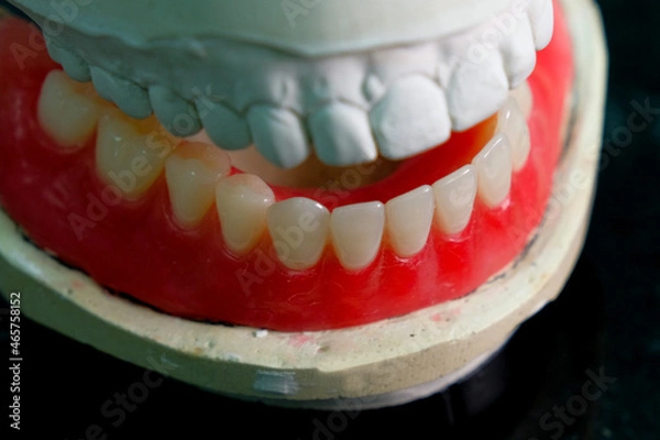 Obraz Dentistry. removable denture for the lower jaw. close-up