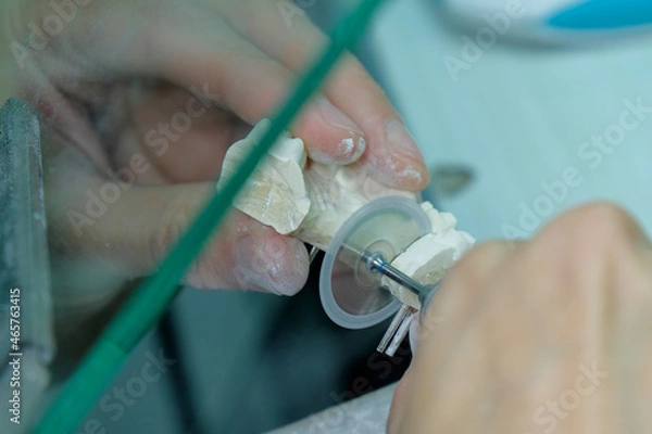 Obraz Dental Technician. Work on tooth crown in dental laboratory.