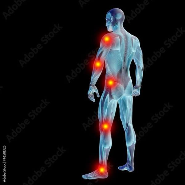 Fototapeta High resolution conceptual 3D human with inflammation