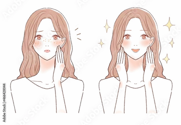 Obraz そばかすを気にする女性のビフォーアフター