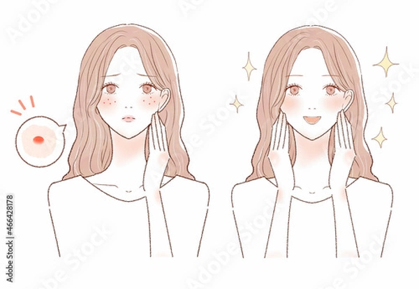Obraz ニキビを気にする女性のビフォーアフター