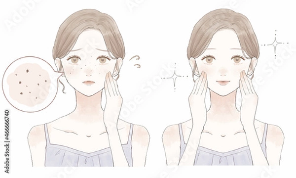 Obraz 黒ずみ毛穴に悩む女性のビフォーアフター
