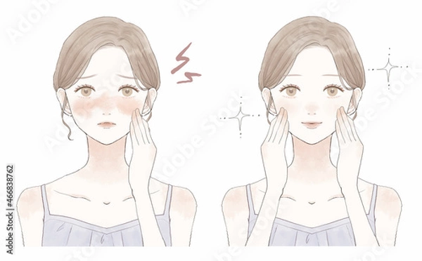 Obraz 肌の炎症に悩む女性のビフォーアフター