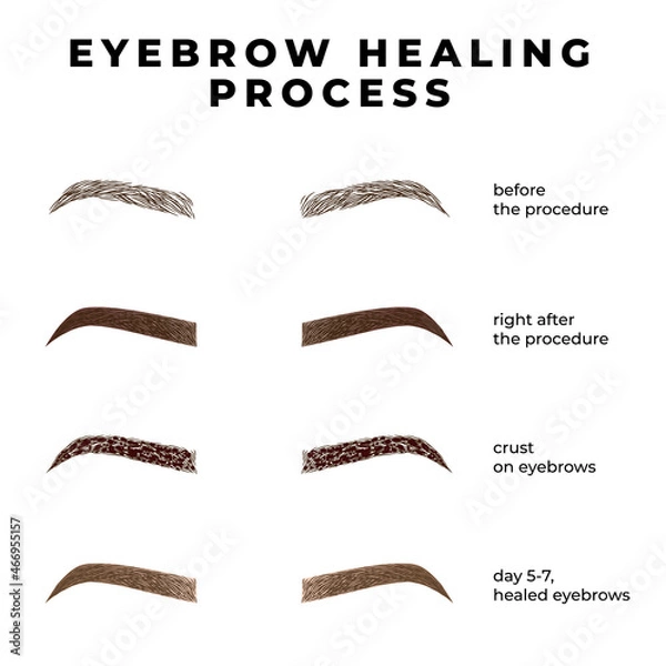 Fototapeta Eyebrows healing process after microblading. Healing stages eyebrows. 