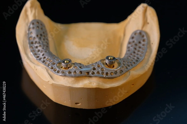 Obraz Dental technician works by brush with jaw model
