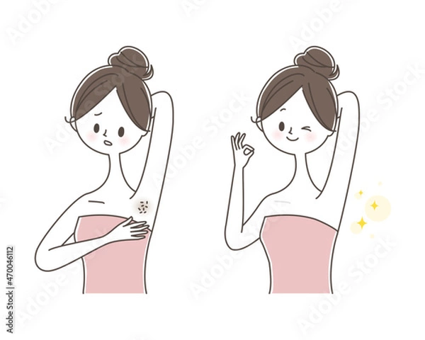 Obraz 脇の脱毛をする女性　ビフォーアフター