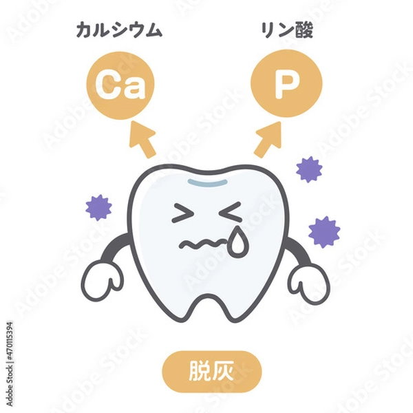 Obraz 脱灰に悩む歯のシンプルで可愛いイラスト