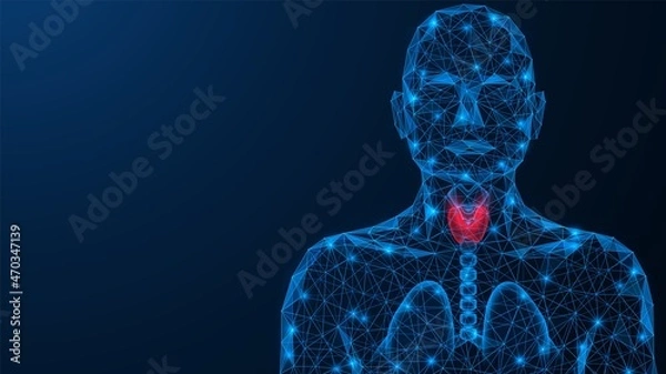 Fototapeta Acute inflammation of the thyroid gland. Low-poly design of interconnected lines and dots. Blue background.