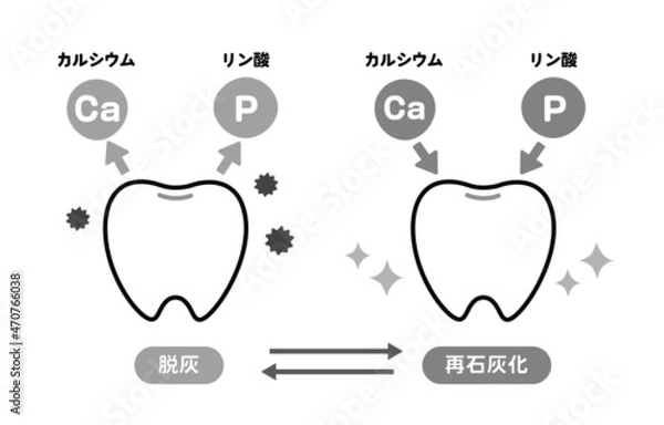 Obraz 脱灰と再石灰化に関する歯のイラスト