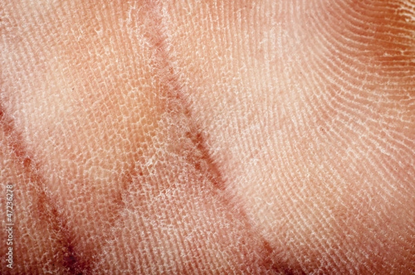 Obraz human dried skin