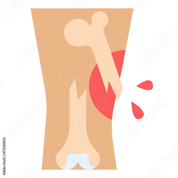 Obraz fracture flat icon