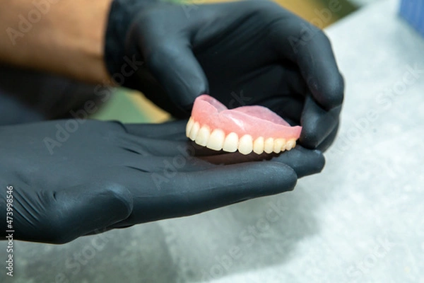 Obraz tooth mold for tooth restoration