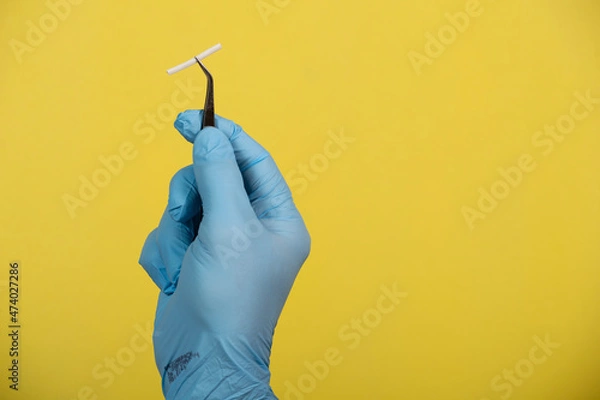 Obraz hand holding a hormonal implant with tweezers