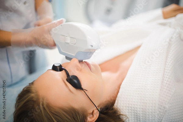 Fototapeta Close up of a young woman face while cosmetologist does the procedure for laser hair removal of unwanted hair of the face and upper lip in a beauty salon