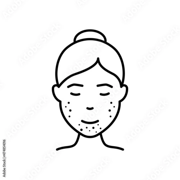 Fototapeta Woman with Blackhead, Acne, Rash on Face Line Icon. Girl with Pimples Face Outline Icon. Allergy, Inflammation Skin, Dermatologic Problem. Editable Stroke. Isolated Vector Illustration