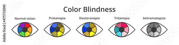 Fototapeta Vector set of icons or symbols of eyes with color blindness or colorblindness isolated on white. Normal vision, protanopia, tritanopia, deuteranopia, achromatopsia. Decreased ability to see colors.