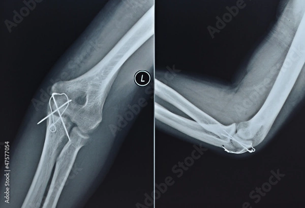 Obraz рентген