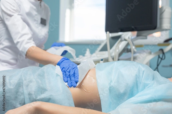 Fototapeta Photo of a doctor wiping medical gel from a pregnant woman's abdomen with a napkin after ultrasound diagnosis of the fetus during a scheduled appointment
