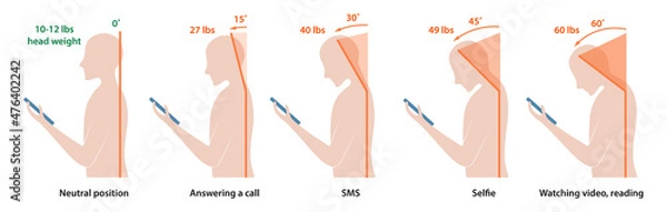 Obraz Computer neck syndrome