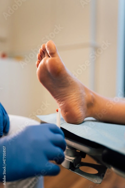 Fototapeta Chiropodist exploring a patient with diabetic foot in the medical center.
