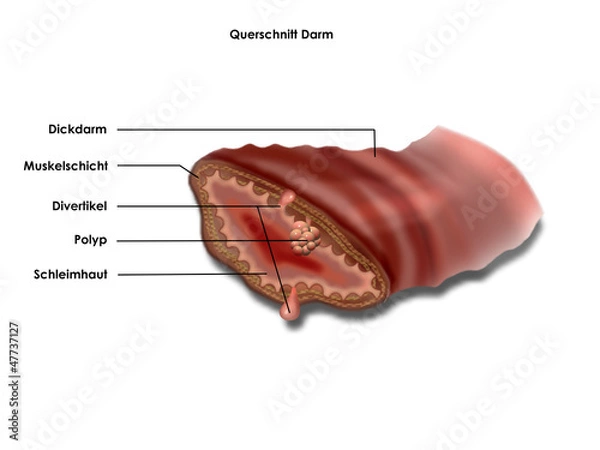 Obraz querschnitt darm
