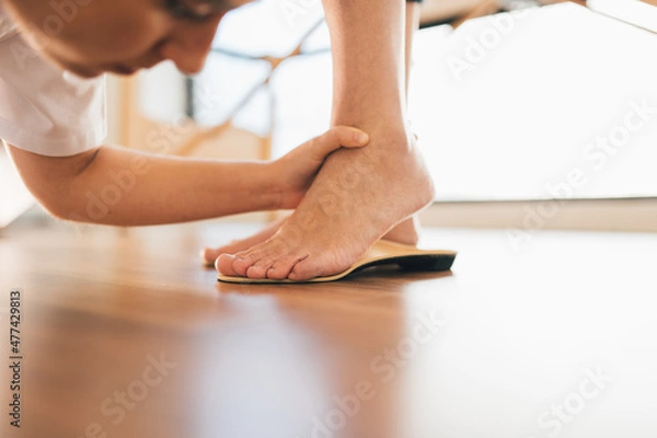 Fototapeta Chiropodist checking the custom foot insole of a patient on the floor in the medical center