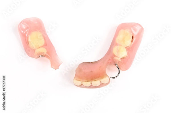 Obraz Draufsicht Interims Prothese gebrochen