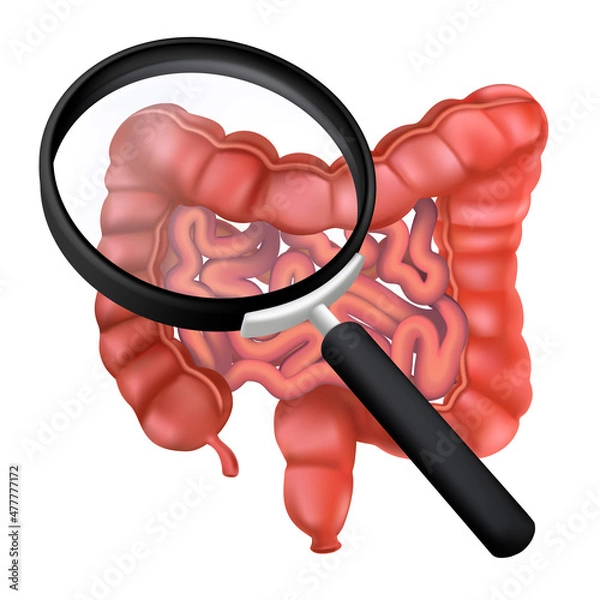 Obraz Realistic human intestines under a magnifying glass. 3D vector illustration of the colon. Studies of the gastrointestinal tract. Anatomical concept of an internal organ isolated on a white background