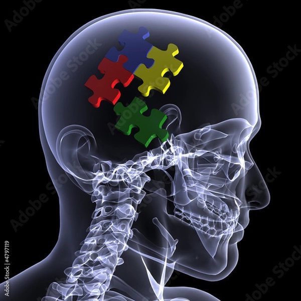 Obraz Skeleton X-Ray - Puzzling 2