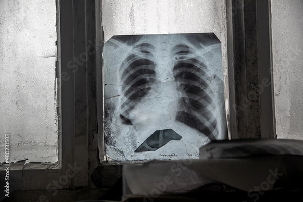 Obraz A snapshot of the lungs in an old abandoned hospital. Lung disease. Abandoned hospital. Window with light.