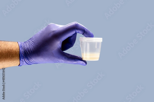 Fototapeta hand wearing nitrile glove holding semen or sperm sample collection container, semen donation concept