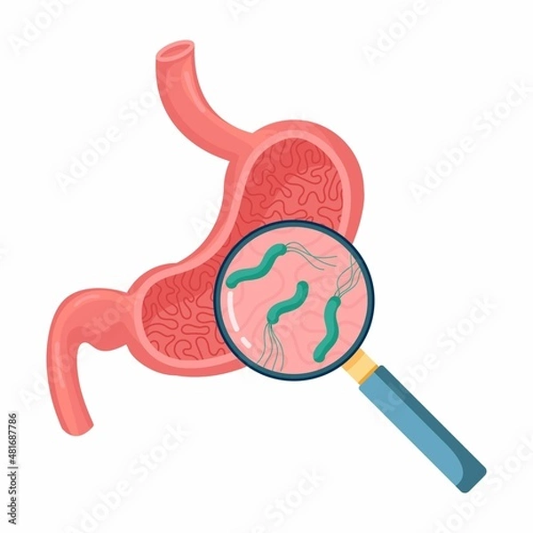 Obraz Helicobacter Pylori in the stomach. Stomach diseases. Bacterium with flagella that causes gastritis. Bacteria under magnifying glass. Vector illustration on white background
