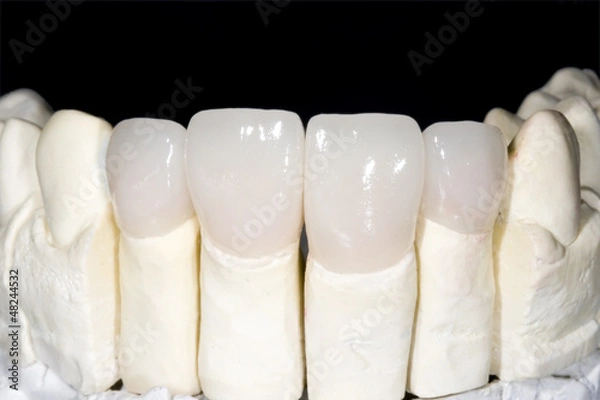 Obraz Korona ceramiczna