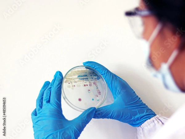 Fototapeta Researcher is holding Petri dish of Vibrio vulnificus in CHROMagar and TCBS, an estuarine bacterium which occurs in in filter-feeding molluscan shellfish, such as oysters., ingestion of the bacterium.