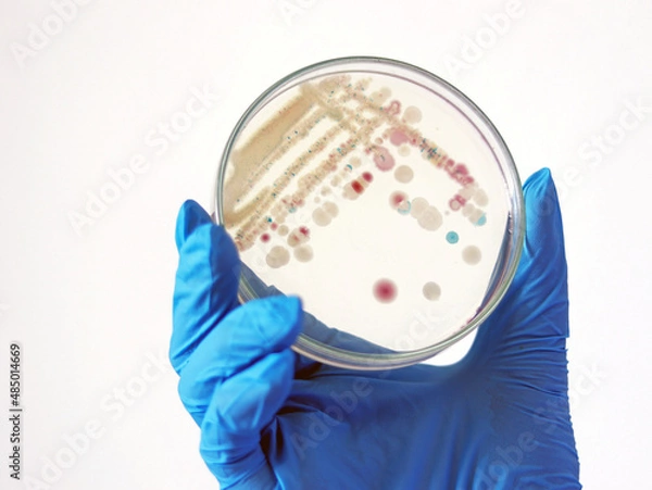 Fototapeta Researcher is holding Petri dish of Vibrio vulnificus in CHROMagar and TCBS, an estuarine bacterium which occurs in in filter-feeding molluscan shellfish, such as oysters., ingestion of the bacterium.
