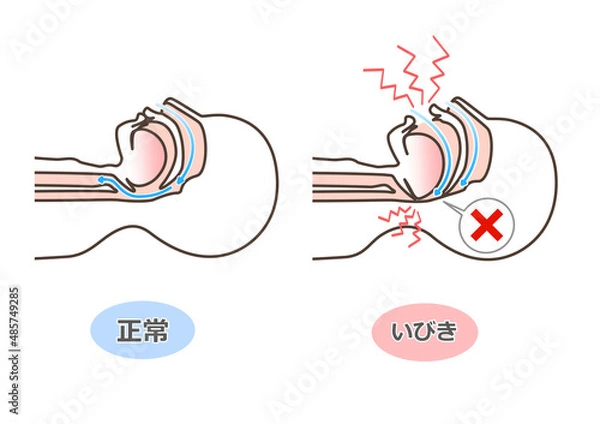 Obraz いびきの図解イラスト