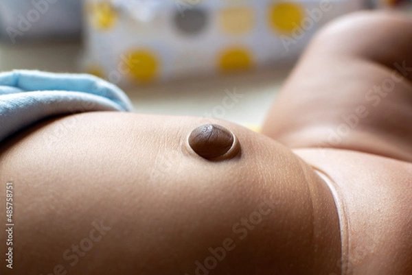 Obraz Closed-up Japanese Asian infant baby's protruding navel