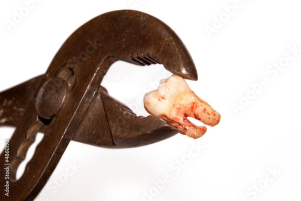 Obraz Removing tooth with a gripper (p0496)
